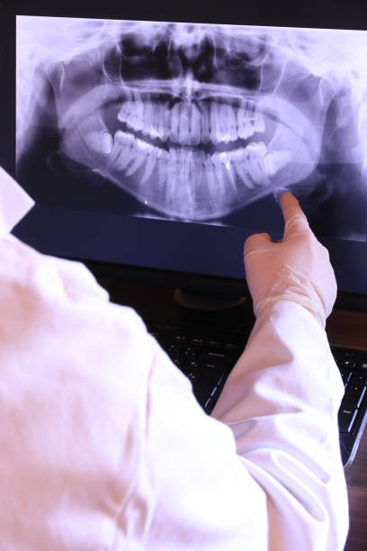 Best Emergency Treatment for Dental Infections or Abscesses in Cincinnati, OH
