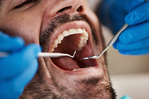 Best Emergency Denture Repair in Cincinnati, OH