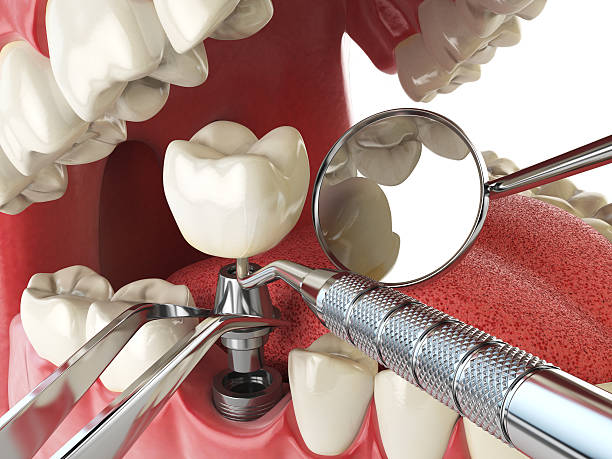 Best Cosmetic Emergency Dentistry in Cincinnati, OH